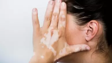 شایع ترین بیماری های پوستی